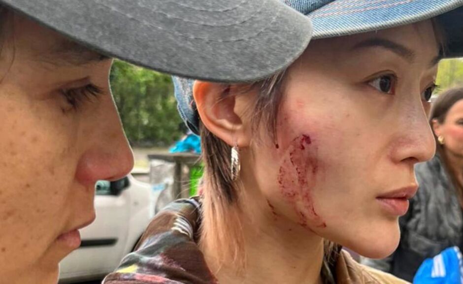 Berlin: Angriff auf ein queeres DJ-Paar